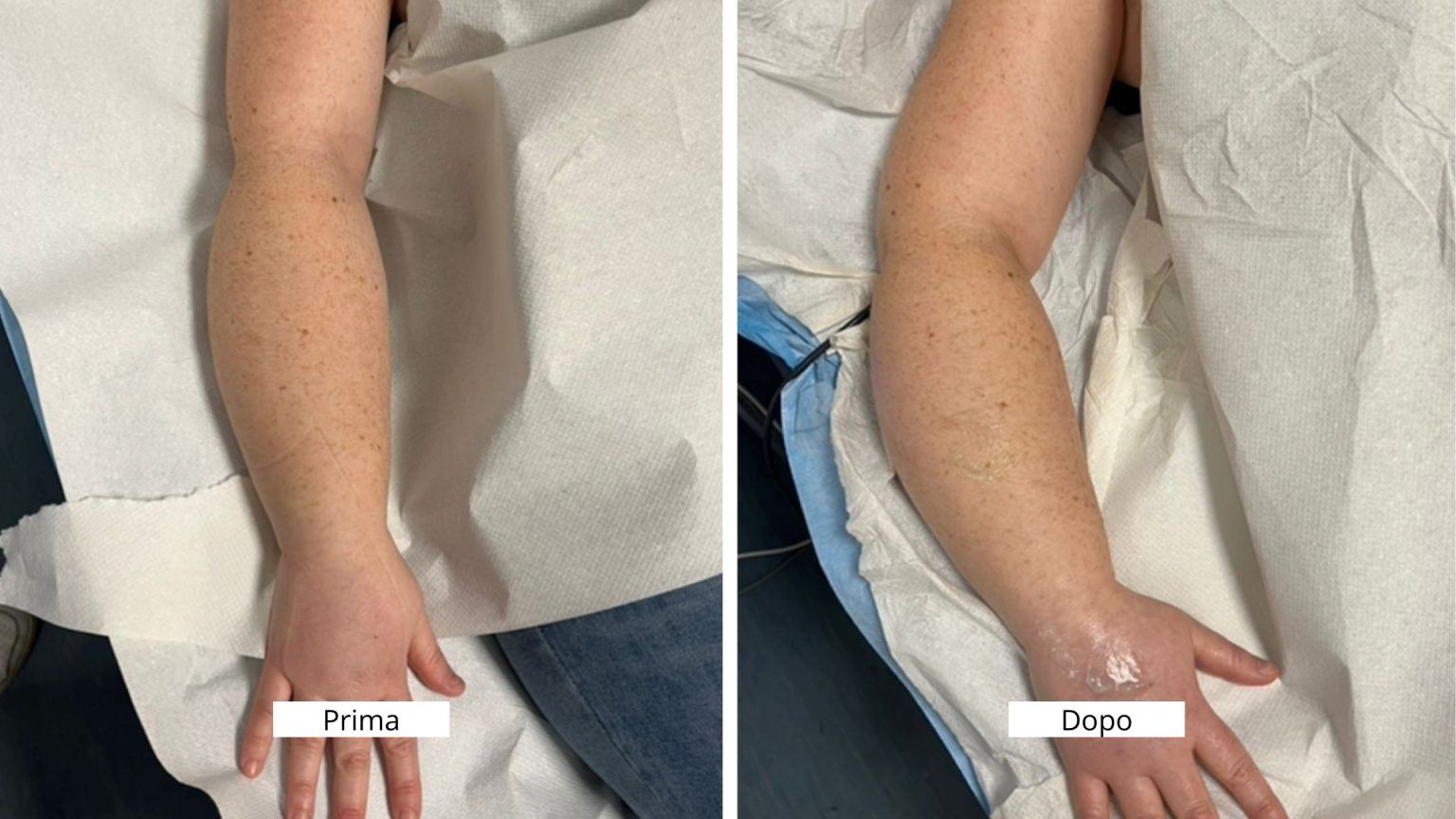 Prima-e-dopo-sito3-1536x864