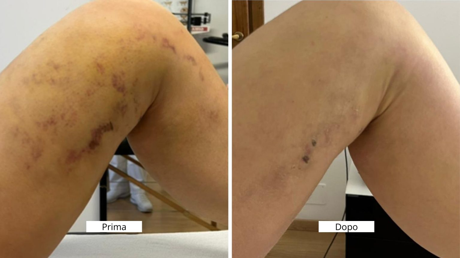 Prima-e-dopo-sito4-1536x864